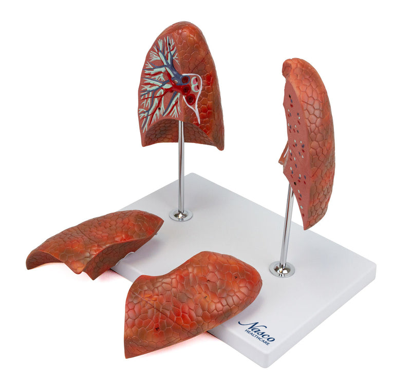 Load image into Gallery viewer, Lung Model, 4 Parts