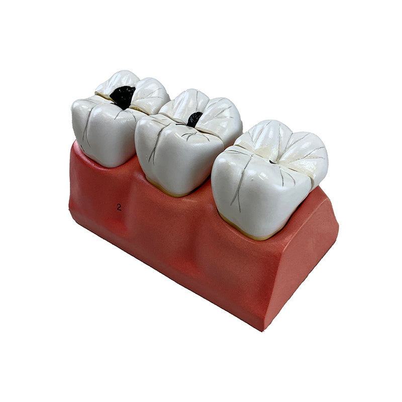 Load image into Gallery viewer, Dental Morphology Model, 4X Enlarged, 7 Parts
