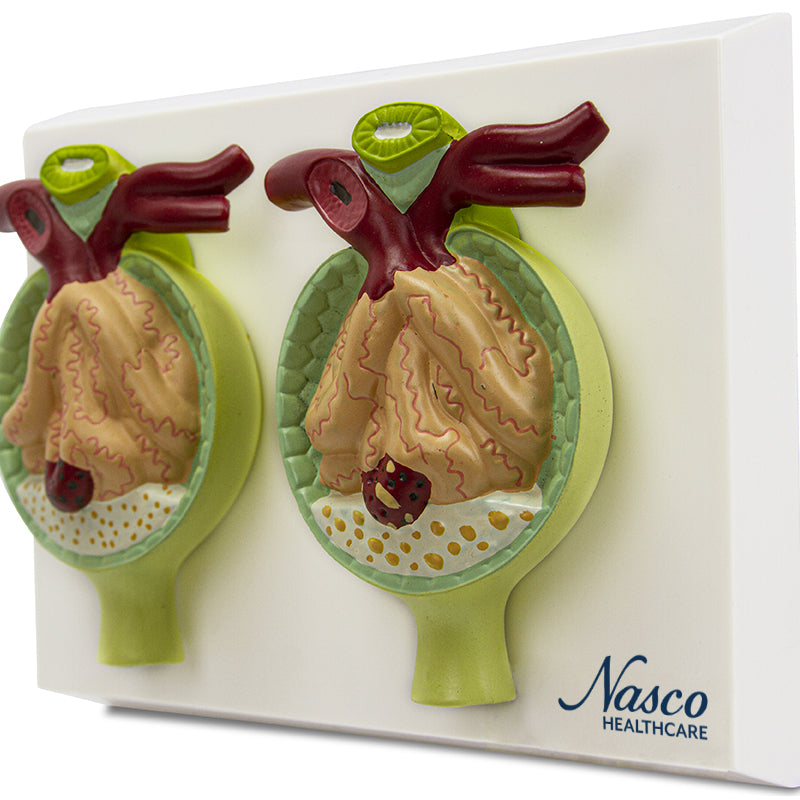 將圖像載入到圖庫檢視器中, Nephrons with Pathology Model, 300X Enlarged