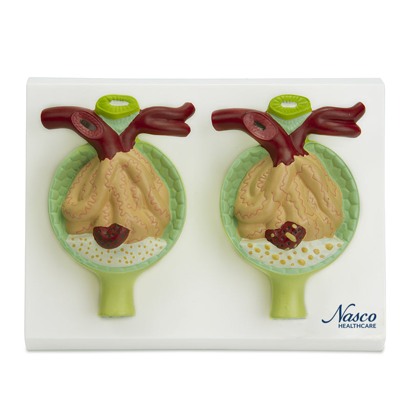 將圖像載入到圖庫檢視器中, Nephrons with Pathology Model, 300X Enlarged