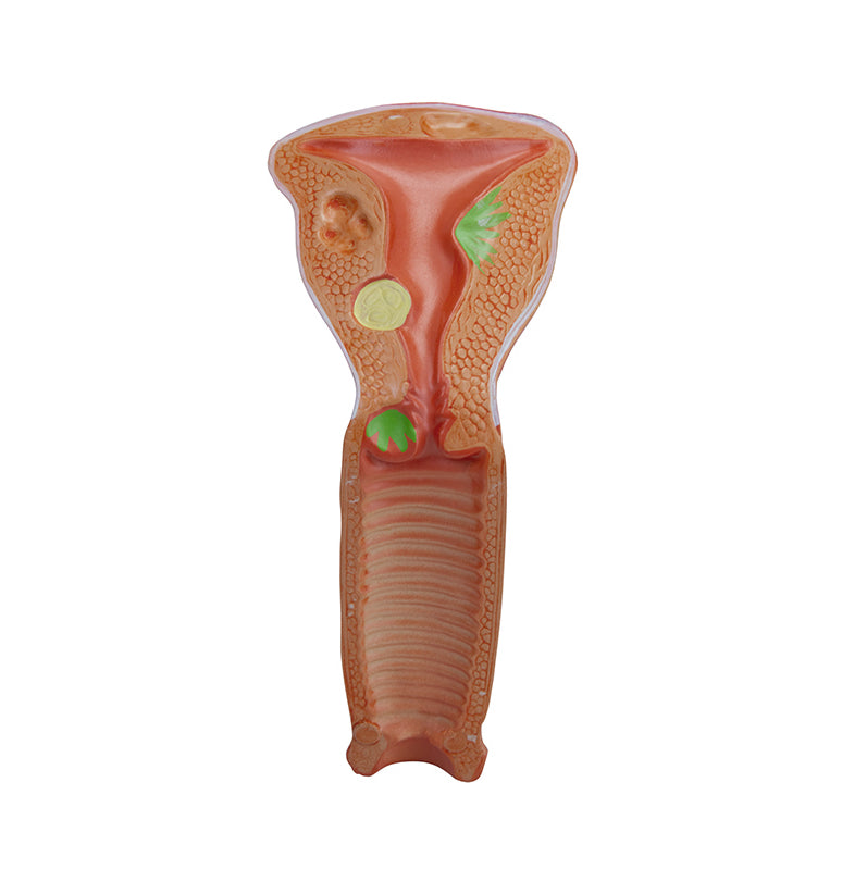 Load image into Gallery viewer, Female Genital Organ with Pathology Model, 2 Parts