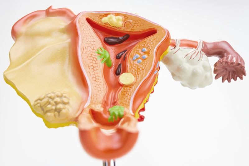 Load image into Gallery viewer, Female Genital Organ with Pathology Model, 2 Parts