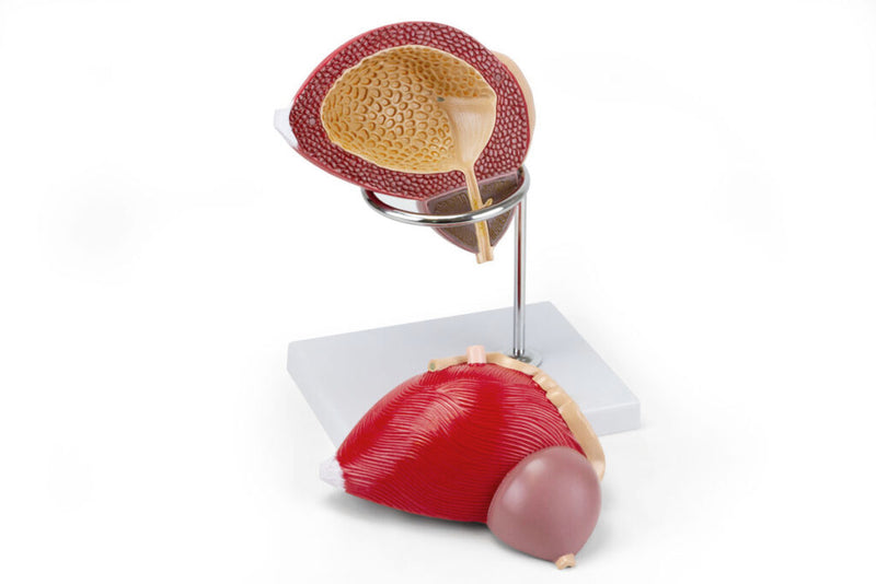 Load image into Gallery viewer, Prostate Model, 3X Enlarged, 2 Parts