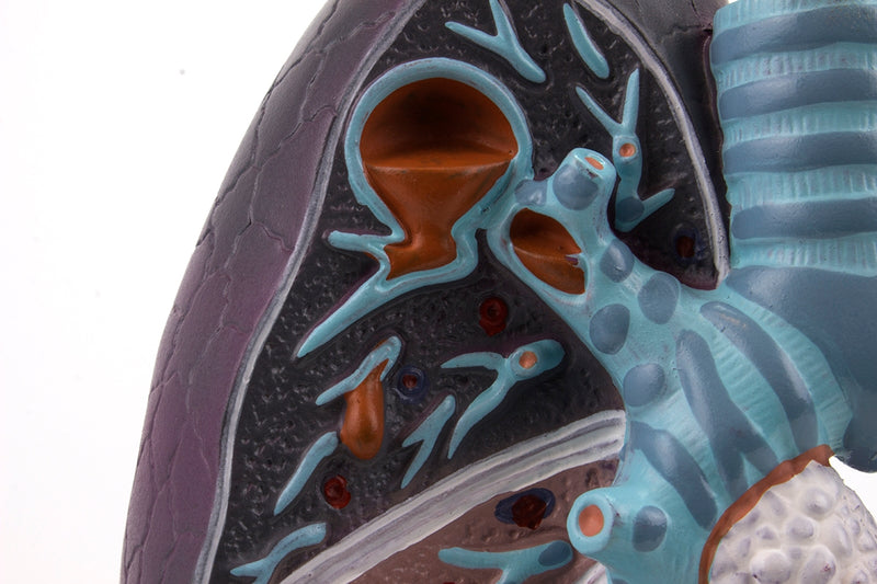 Tải hình ảnh vào trình xem Thư viện, Lung with Pathology Model, 1.5X Enlarged