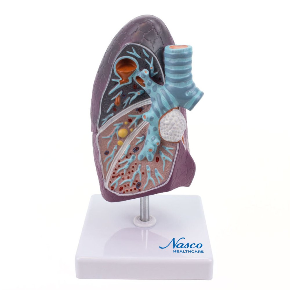 専用♡LUNGS MG30885.jpg?v=1753494177