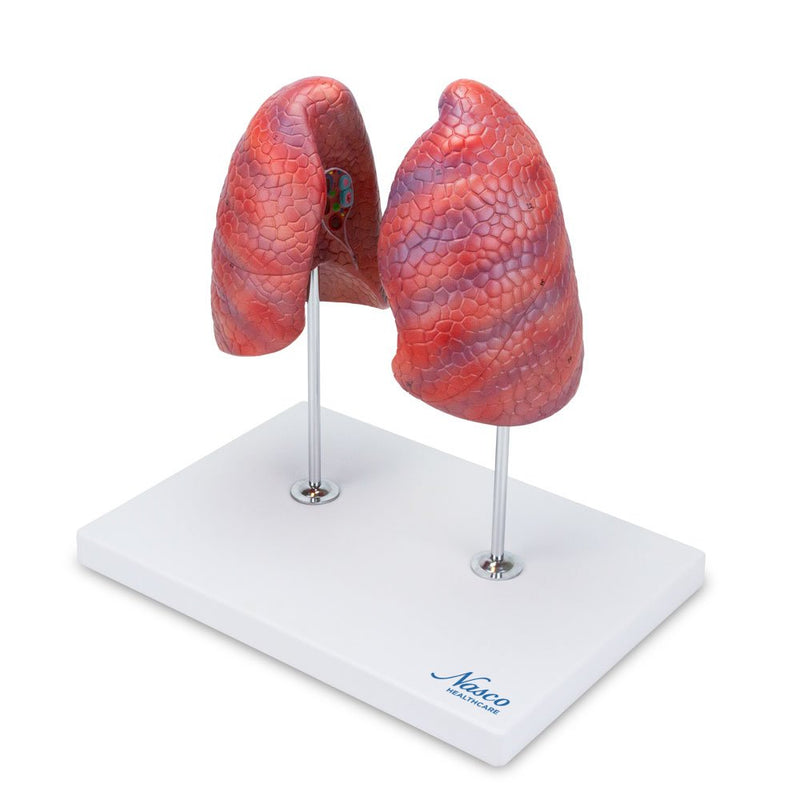 Tải hình ảnh vào trình xem Thư viện, Lung Model, 2 Parts