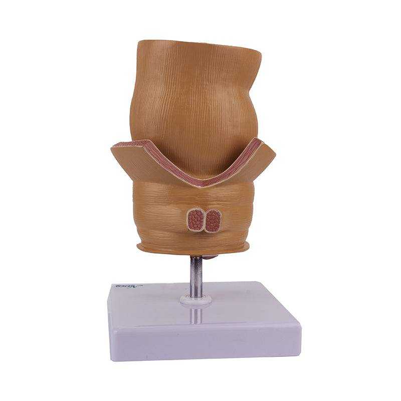 Load image into Gallery viewer, Hemorrhoids Model, 5X Enlarged