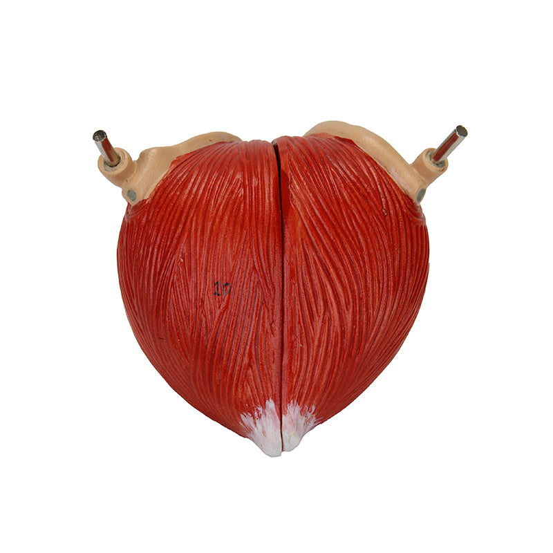 Load image into Gallery viewer, Kidneys with Vessels & Urinary System, 4 Parts