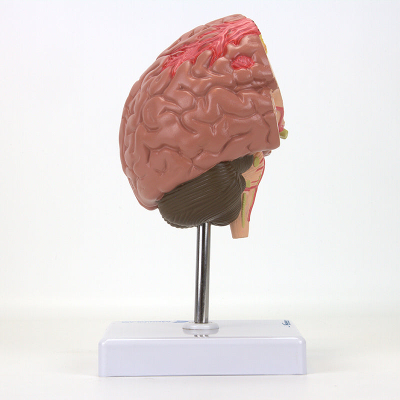 Load image into Gallery viewer, Brain Section with Pathology Model