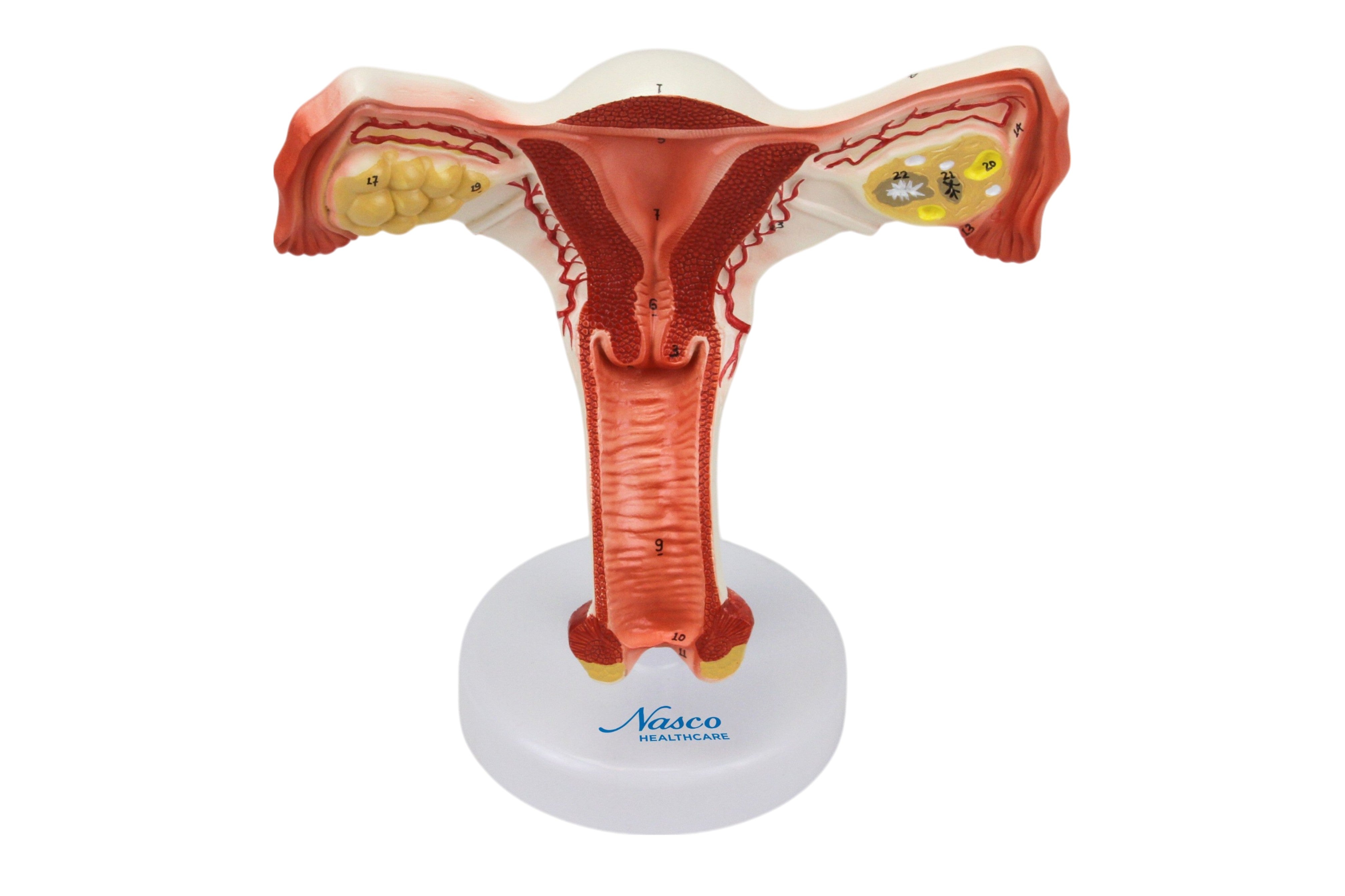 여성 생식 기관 섹션, 1.5배 확대 [SKU: MG31101] – Nasco Healthcare, image size:4032x2688