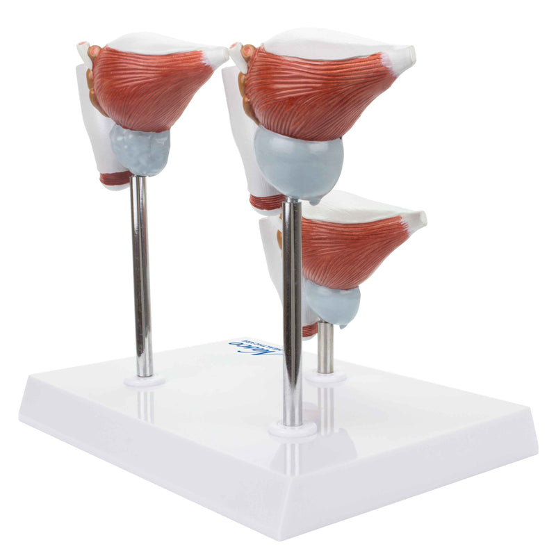 Load image into Gallery viewer, Normal and Pathological Prostate Models, 3 Parts