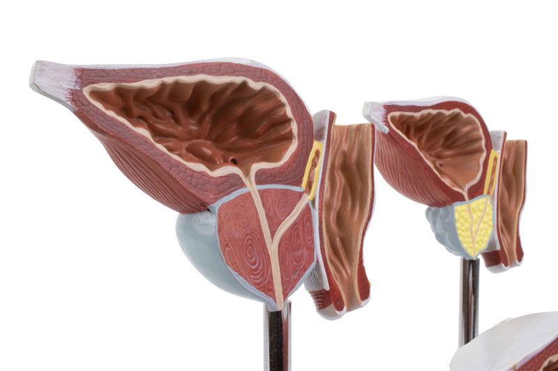 Load image into Gallery viewer, Normal and Pathological Prostate Models, 3 Parts