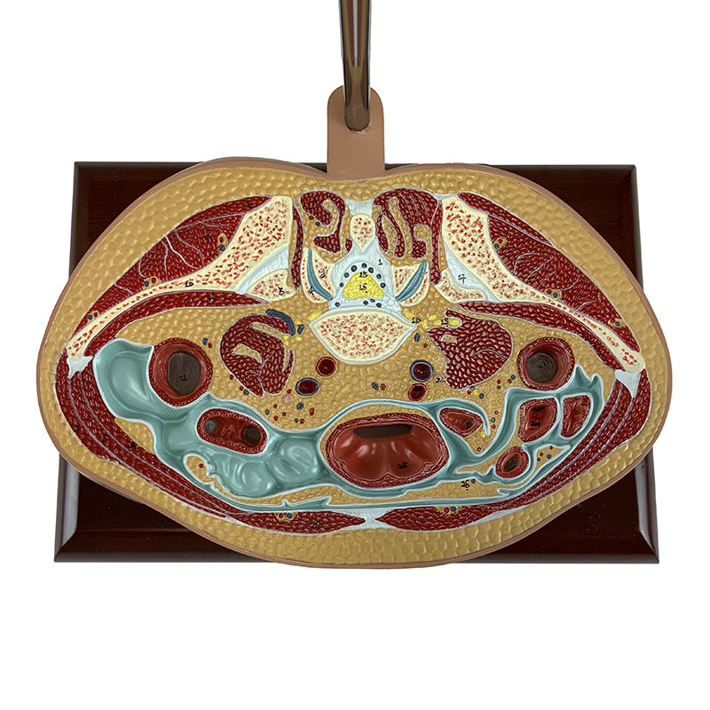 Load image into Gallery viewer, Torso Section Model, 24 Discs