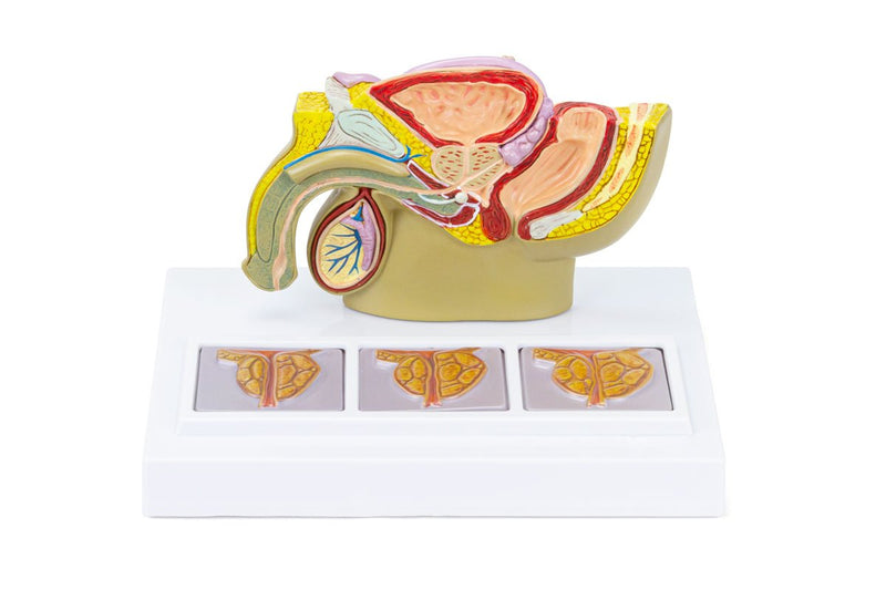 将图像加载到画廊查看器中,Male Pelvis with Prostate Model, Half-Size