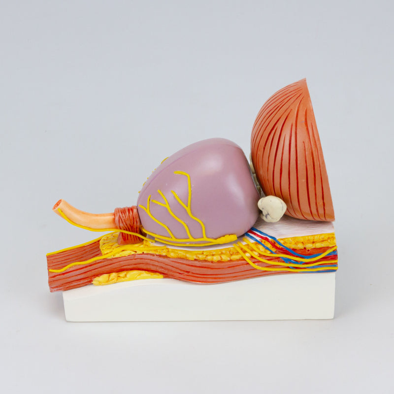 Load image into Gallery viewer, Prostate with Pathology Model