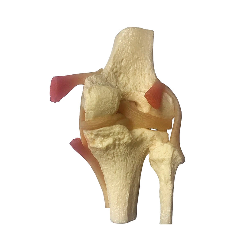 将图像加载到画廊查看器中,Meniscus Knee with 6 Tears Model