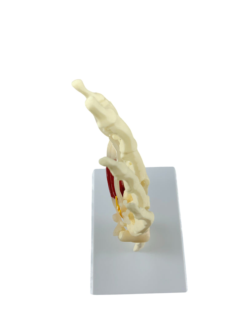 Load image into Gallery viewer, Carpel Tunnel Syndrome Model