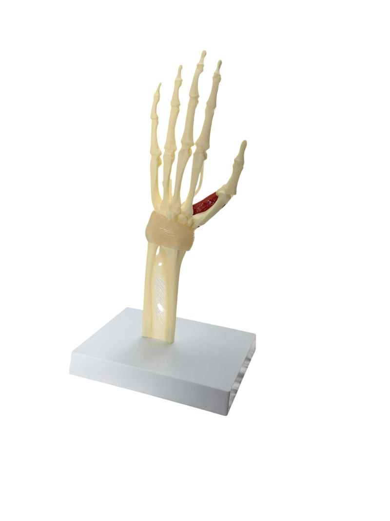 Load image into Gallery viewer, Carpel Tunnel Syndrome Model