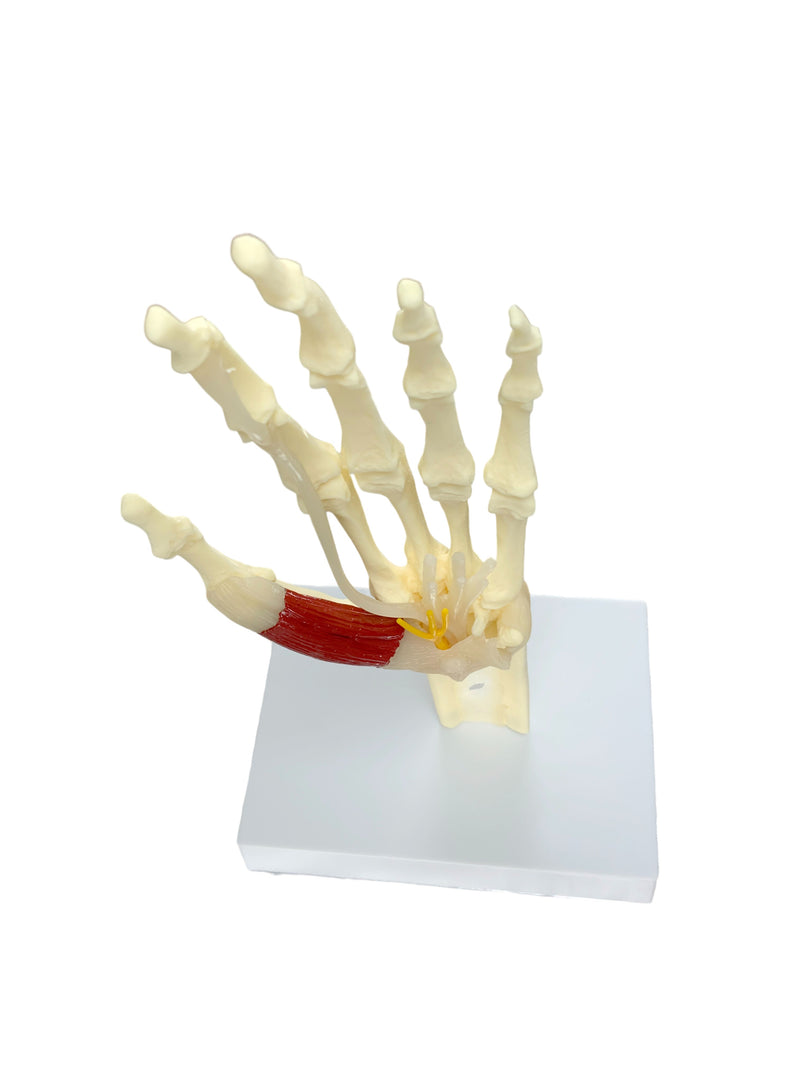 Load image into Gallery viewer, Carpel Tunnel Syndrome Model