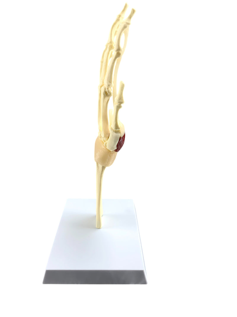 Load image into Gallery viewer, Carpel Tunnel Syndrome Model
