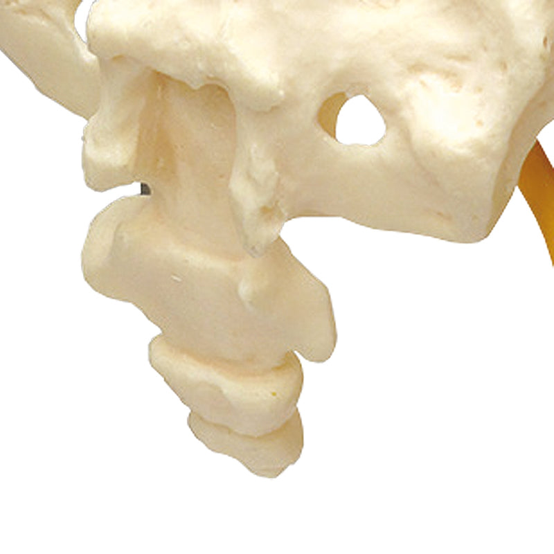 Load image into Gallery viewer, Hip with Muscles and Sciatic Nerve Model