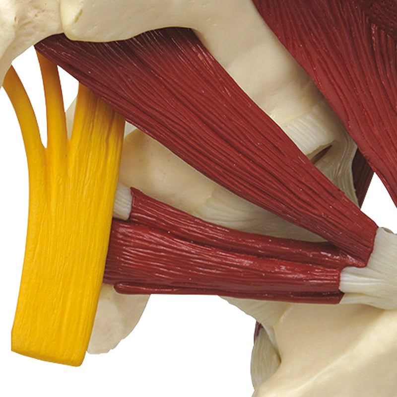 Load image into Gallery viewer, Hip with Muscles and Sciatic Nerve Model
