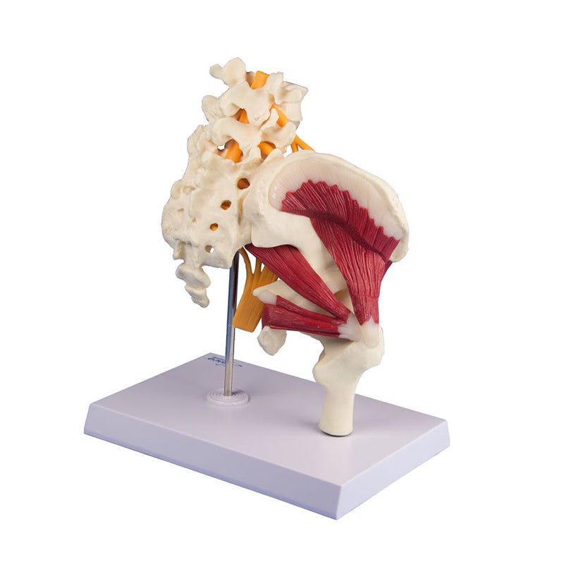 Load image into Gallery viewer, Hip with Muscles and Sciatic Nerve Model