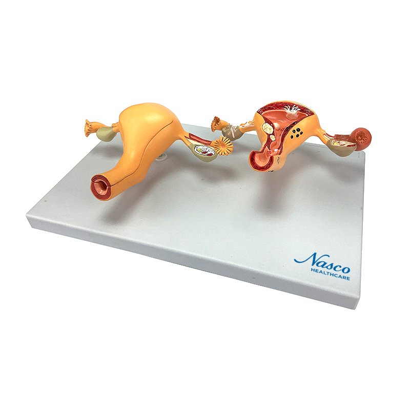 Load image into Gallery viewer, Healthy & Pathological Uterus Model