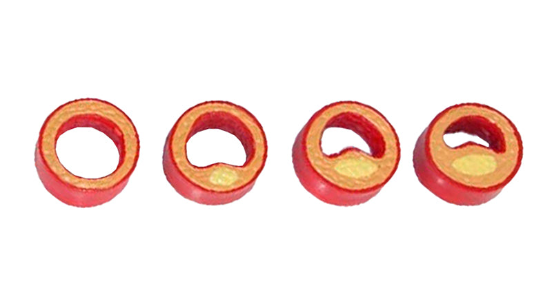 Load image into Gallery viewer, Heart with Arteriosclerosis Model