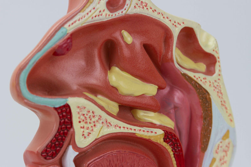 將圖像載入到圖庫檢視器中, Nasal & Oral Cross Section with Pathology Model