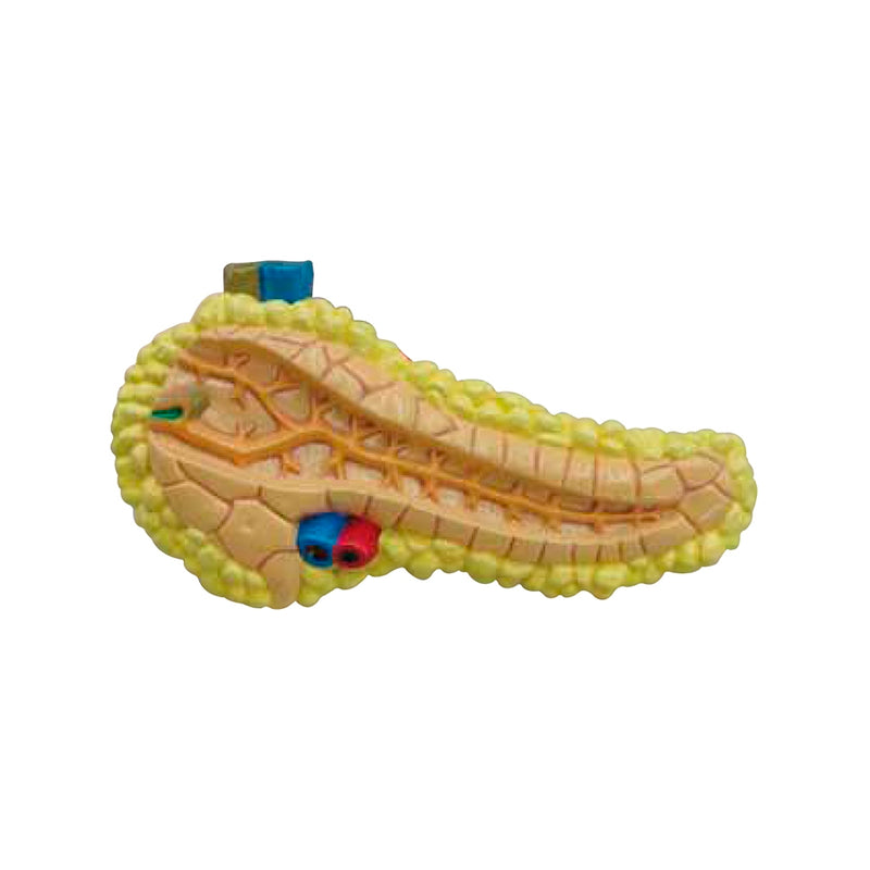 Load image into Gallery viewer, Effects of Type II Diabetes Model