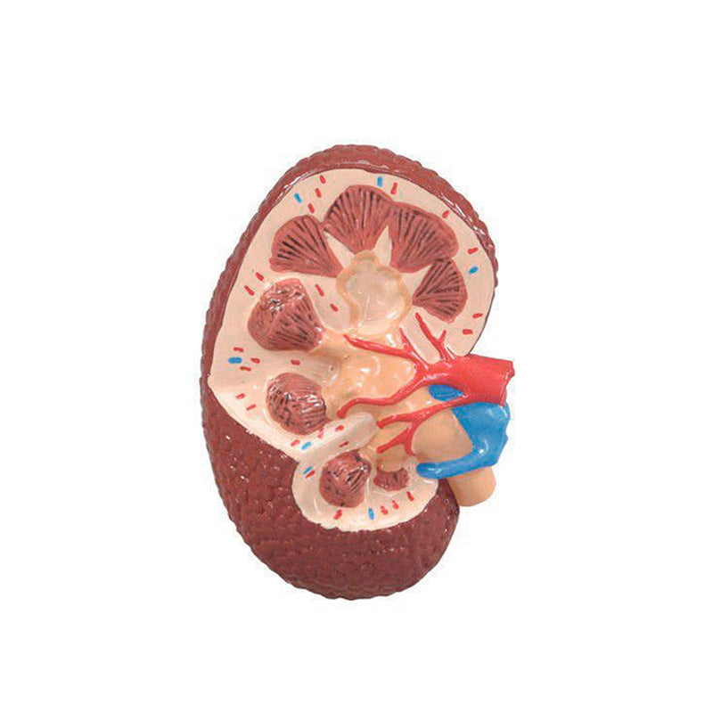 Load image into Gallery viewer, Effects of Type II Diabetes Model