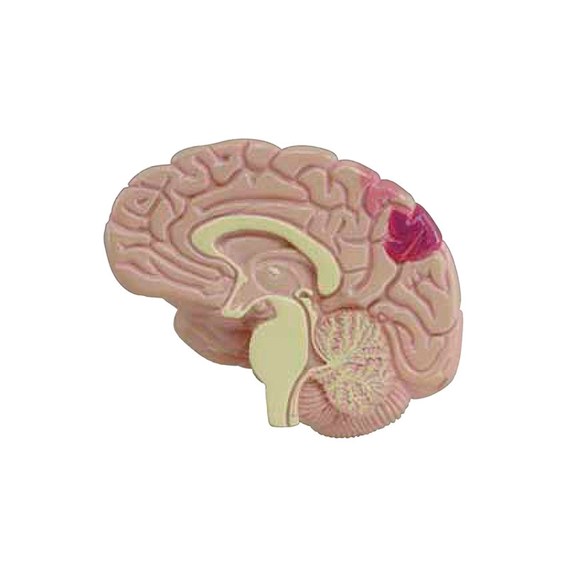 Load image into Gallery viewer, Effects of Type II Diabetes Model