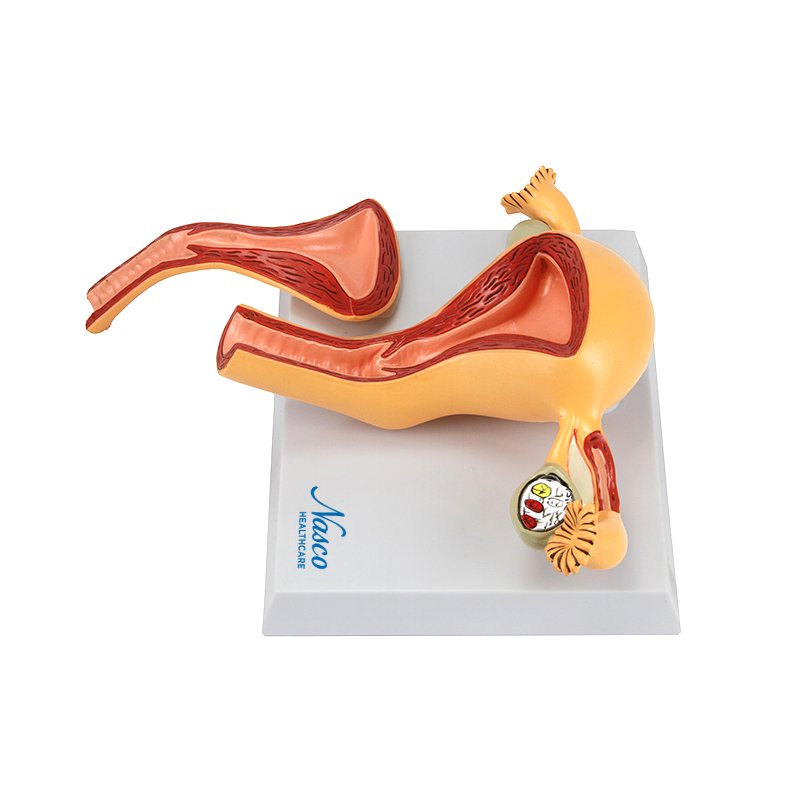 Load image into Gallery viewer, Uterus with Ovary Model, 2-Parts