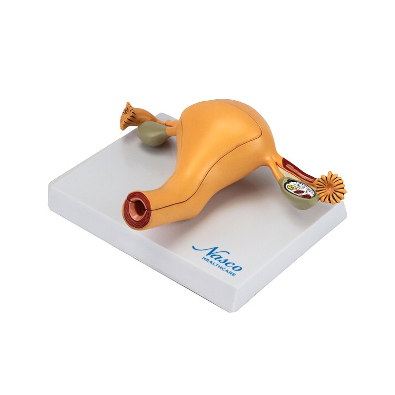 Load image into Gallery viewer, Uterus with Ovary Model, 2-Parts