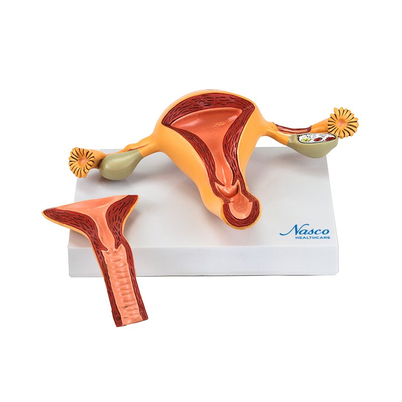 Load image into Gallery viewer, Uterus with Ovary Model, 2-Parts