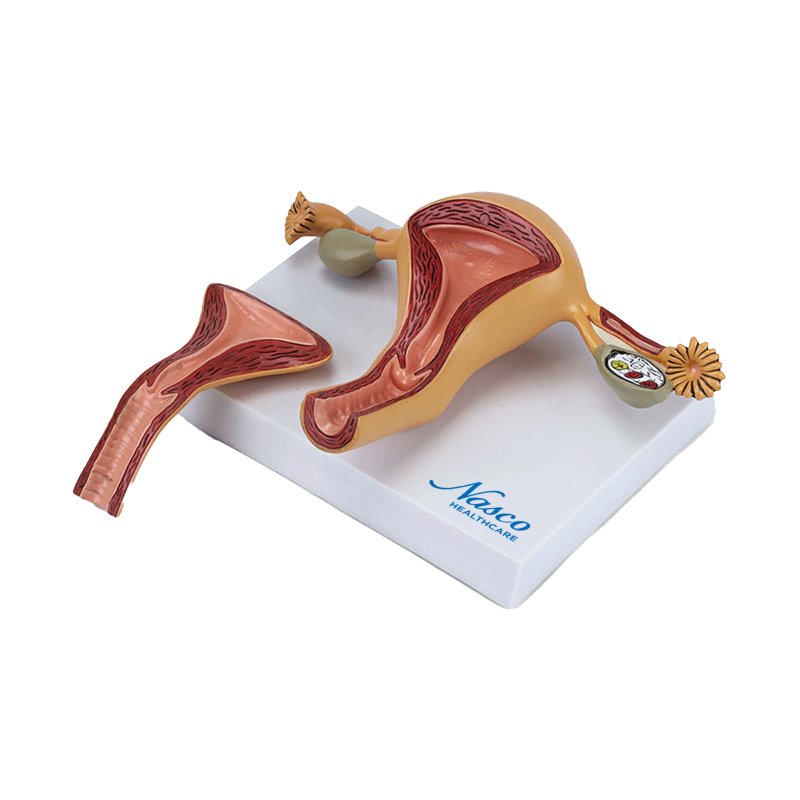 Load image into Gallery viewer, Uterus with Ovary Model, 2-Parts