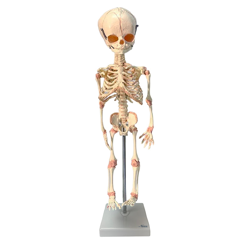 Load image into Gallery viewer, Fetal Skeleton