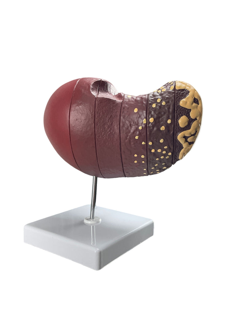 將圖像載入到圖庫檢視器中, Liver Section with Pathology Model
