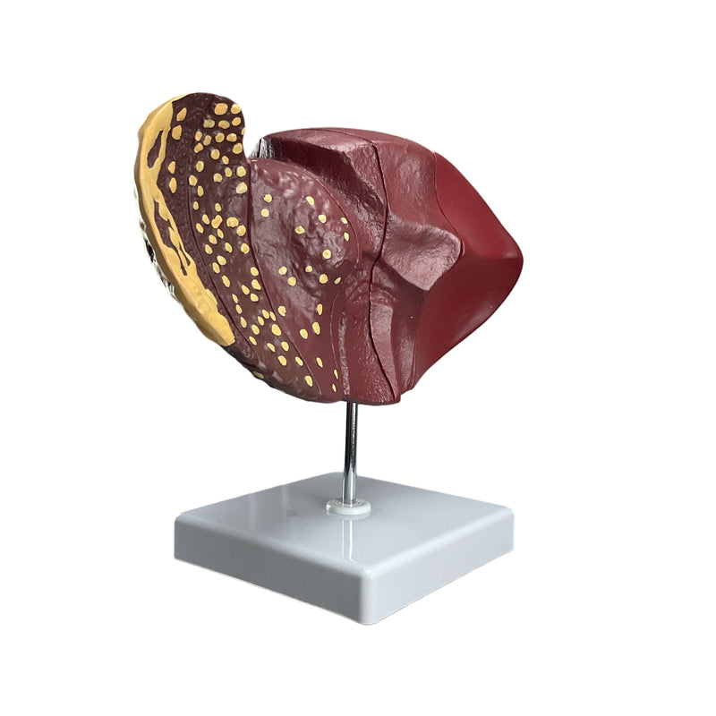 將圖像載入到圖庫檢視器中, Liver Section with Pathology Model
