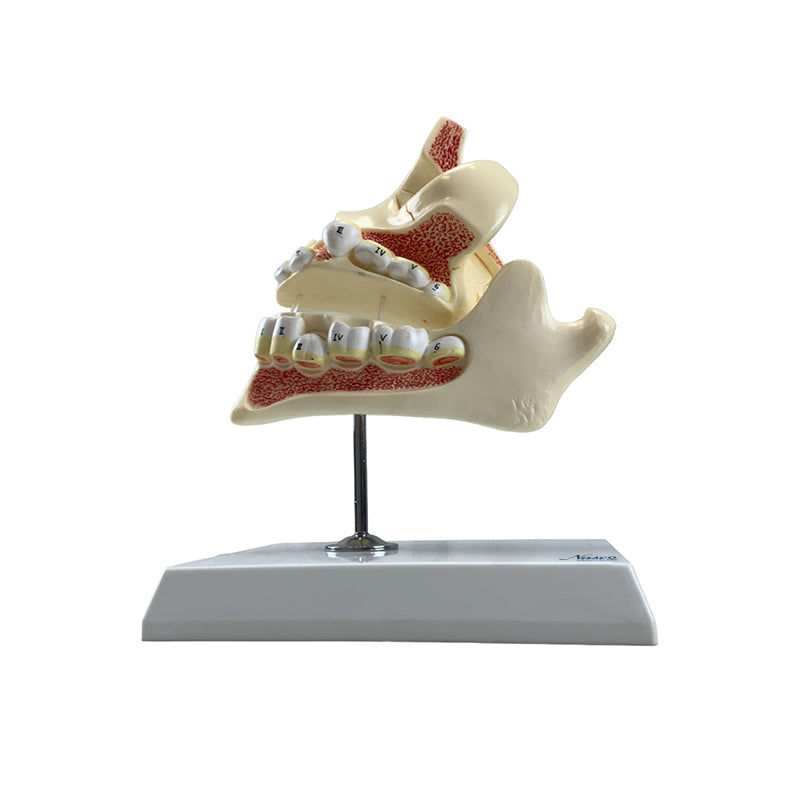 Load image into Gallery viewer, Development of Dentition Models Set, 4 Stages