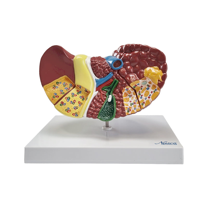 Load image into Gallery viewer, Liver Section with Pathologies Model