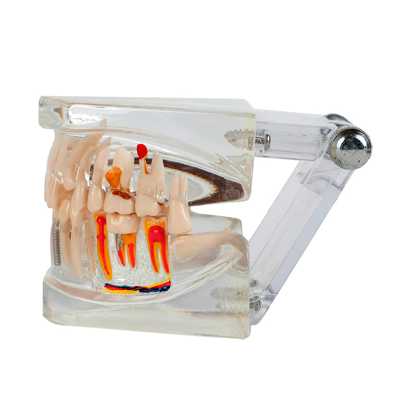 Load image into Gallery viewer, Translucent Adult Dentition Normal and Pathology Model