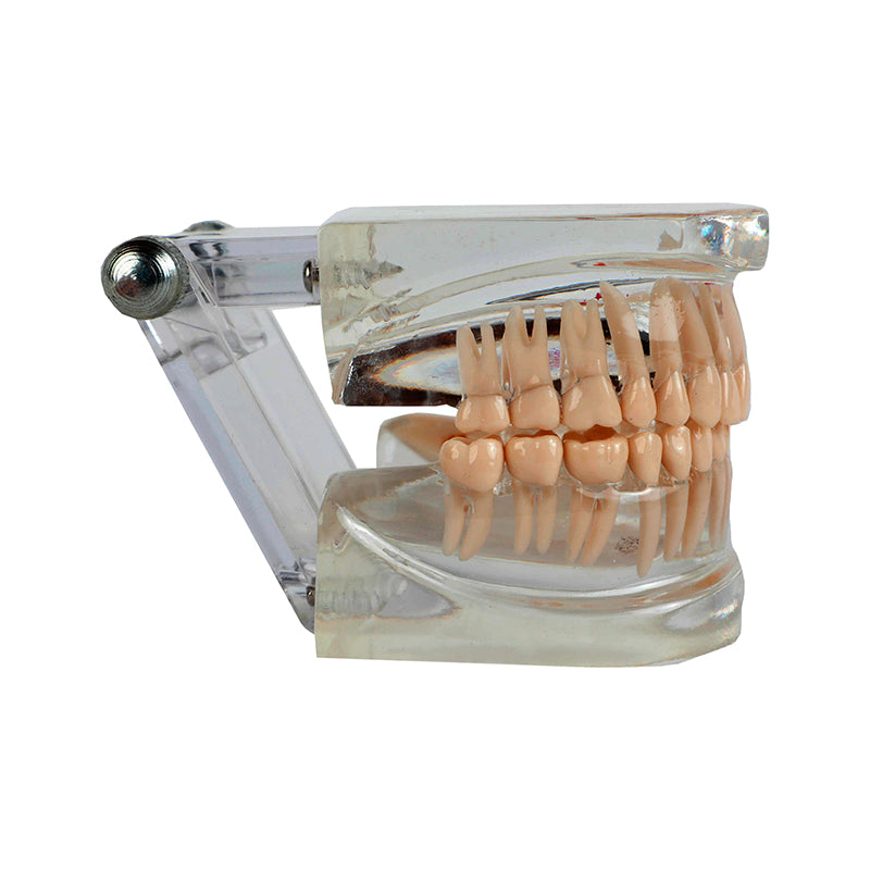Load image into Gallery viewer, Translucent Adult Dentition Normal and Pathology Model