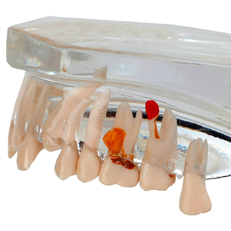 Load image into Gallery viewer, Translucent Adult Dentition Normal and Pathology Model