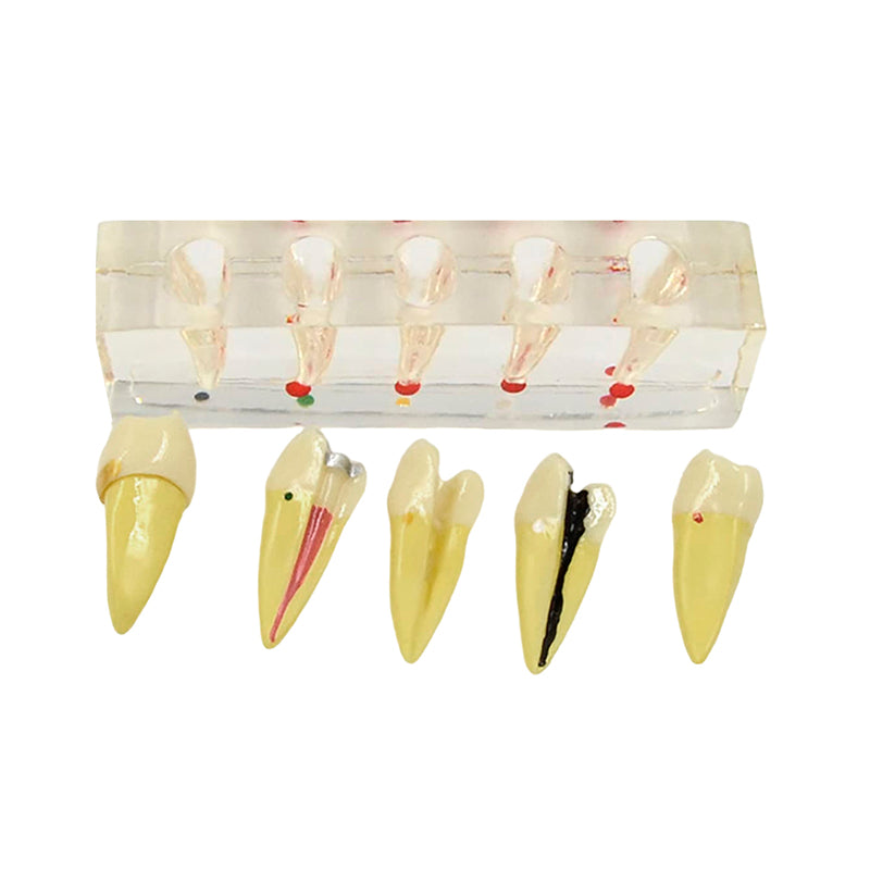 Load image into Gallery viewer, Endodontics Dental Model, 5 Parts