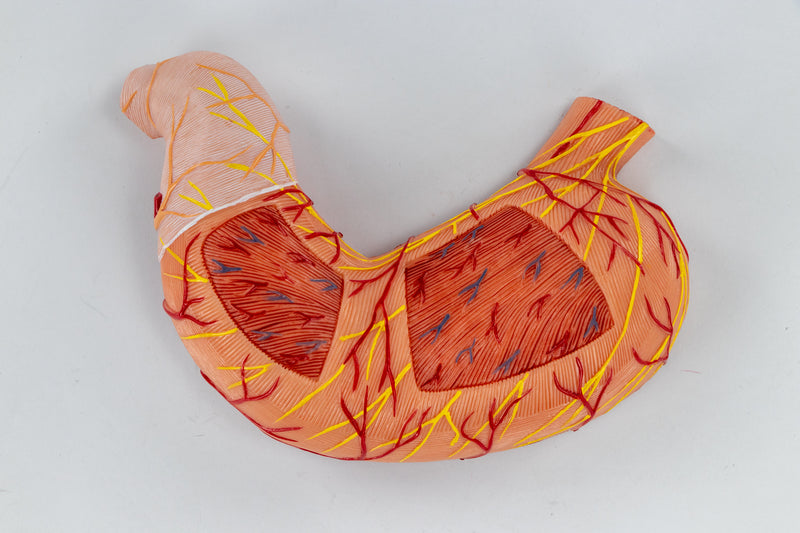 Load image into Gallery viewer, Stomach with Pancreas & Duodenum Model, 3 Parts