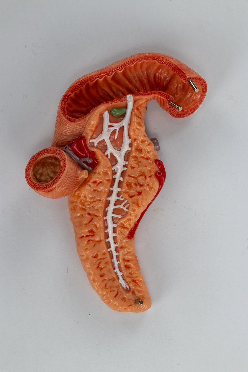 Load image into Gallery viewer, Stomach with Pancreas & Duodenum Model, 3 Parts