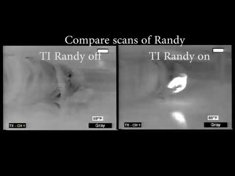 Load and play video in Gallery viewer, Thermal Image Ti Randy 145 Large Body