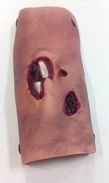 Bild in der Galerieansicht laden, Offene Fraktur, Schienbein